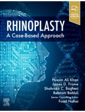 Rhinoplasty: a Case-based approach 1ed (ISBN: 9780323697750)