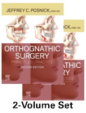 Orthognathic Surgery - 2 Volume Set: Principles and Practice 2ed (ISBN: 9780323791823)