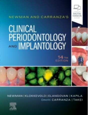 Newman and Carranza's Clinical Periodontology and Implantology: 14ed (ISBN: 9780323878876)