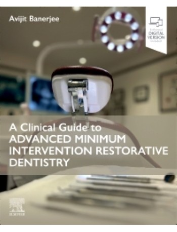 A Clinical Guide to Advanced Minimum Intervention Restorative Dentistry: 1ed (ISBN: 9780443109713)